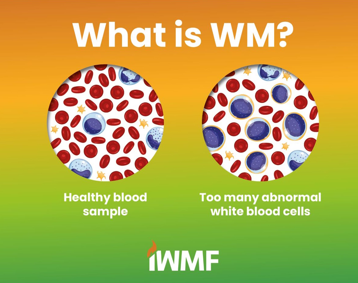 About WM